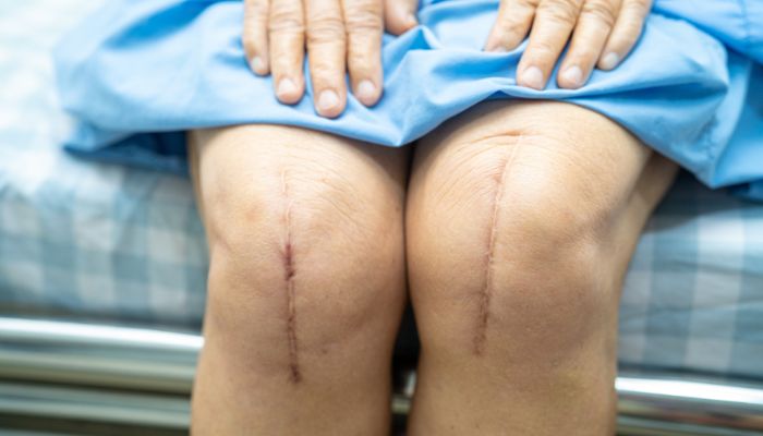 best knee replacement surgery in dubai
