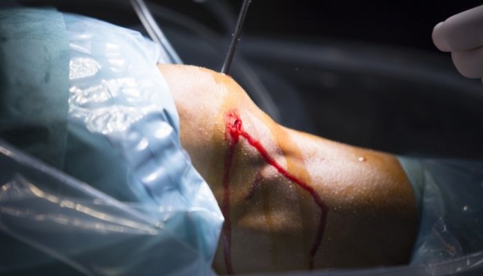 Arthroscopy knee surgeon in Dubai