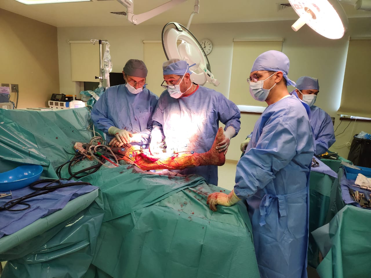 Mako Robot Assisted Knee Surgery