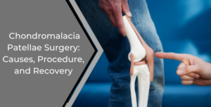 chondromalacia patella surgery